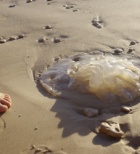 קומפרסים קרים - תמונת המחשה