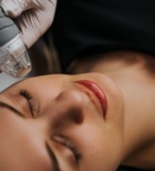 הסרת צלקות בלייזר - תמונת המחשה