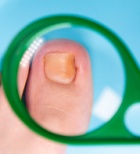 פס שחור, כתמים צהובים ועיבוי: מה הציפורניים מגלות על בריאותכם?-תמונה