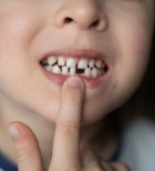 אוטו-טרנספלנטציה: הפרוצדורה המדהימה שמצילה ילדים מסבל-תמונה