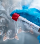 רמות גבוהות של אנזימי כבד - תמונת אווירה