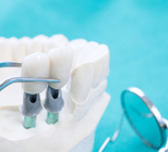 רמות גבוהות של אנזימי כבד - תמונת אווירה