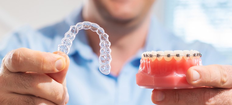 יישור שיניים בשיטה שקופה