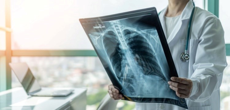 בדיקת דימות ריאות