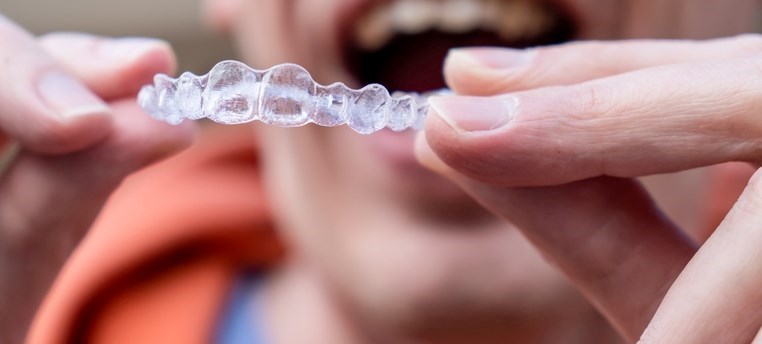 קשתיות שקופות