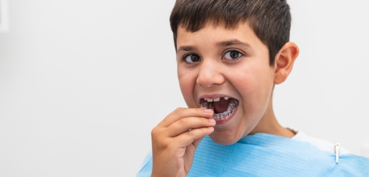 יישור שיניים שקוף