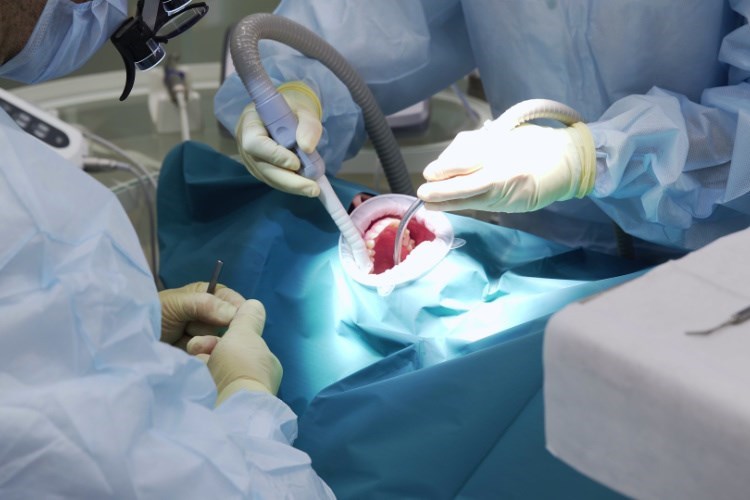 טפיולי שיניםי