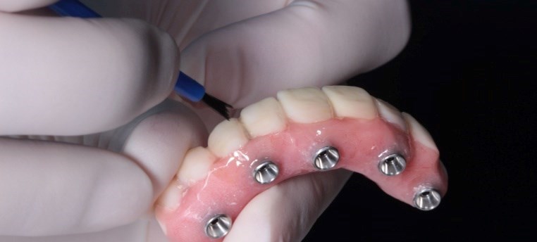 שיניים תותבות