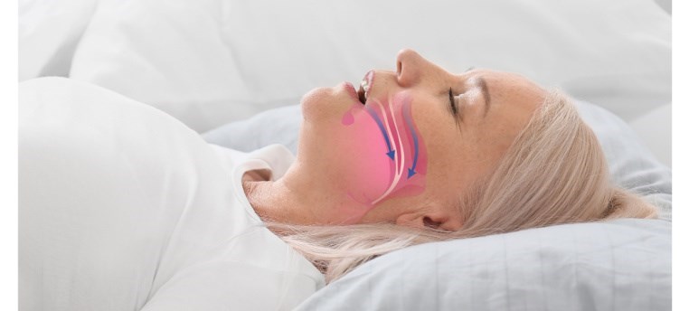 נתיב אוויר בנשימה