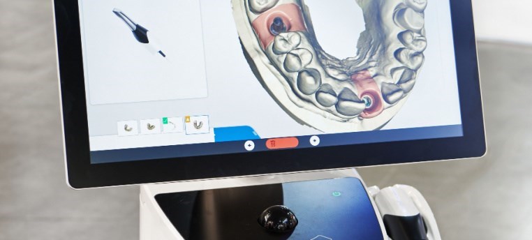 השתלת שיניים