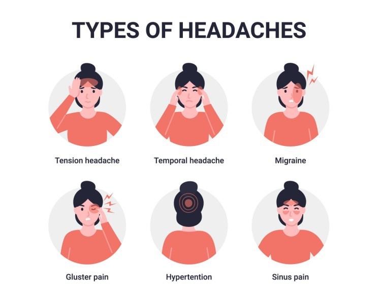סוגי כאב ראש. צילום: שאטרסטוק