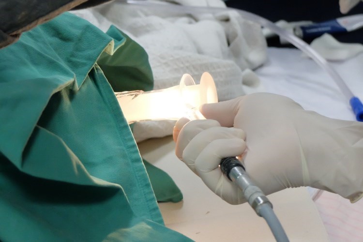 פרוקטוסקופיה