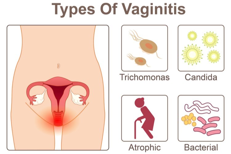 הפרשות מנרתיק
