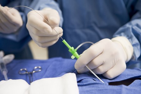 הצנתור הטיפולי הוא הליך פשוט יותר מבחינת החולה. צילום: שאטרסטוק