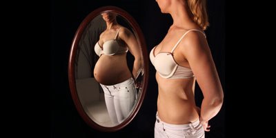 פונדקאות (אילוסטרציה)