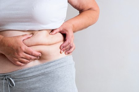 הרזייה ללא ניתוח. אילוסטרציה: שאטרסטוק