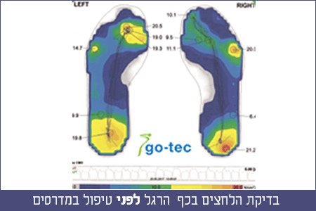 צילום: באדיבות עמית אורתופדיה