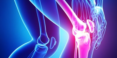 טיפול בבעיות ברכיים. אילוסטרציה: שאטרסטוק