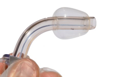 דרך הפתח בקנה, מחדירים צינורית אל מתחת למיתרי הקול. צילום: שאטרסטוק