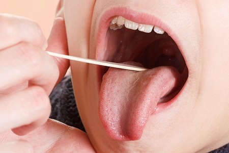 דלקת שקדים בקרב ילדים. אילוסטרציה: שאטרסטוק