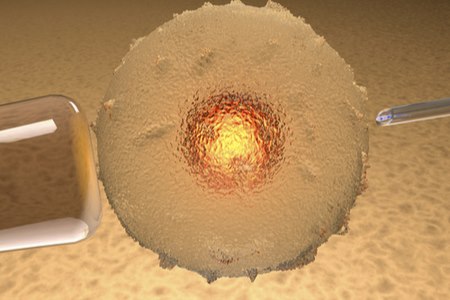 בכל הליך IVF, מתעוררת הדילמה בין הרצון להחזיר כמה שיותר עוברים - לבין החשש מהריון מרובה עוברים. צילום: שאטרסטוק