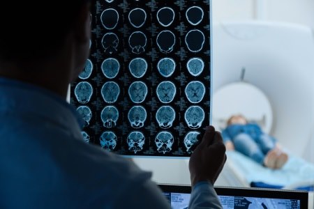 לפני הטיפול מבצעים MRI, כדי להדגים את הפתולוגיה המוחית. צילום: thinkstock