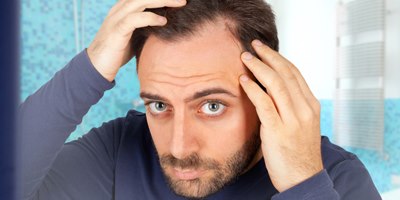 התקרחות על רקע נפשי? (אילוסטרציה: shutterstock)