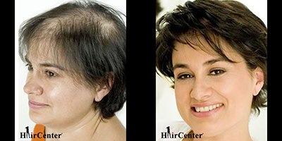 צילום: HairCenter
