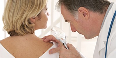 גידולים סרטניים של העור (אילוסטרציה)