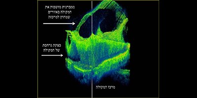 צילום: פרופ
