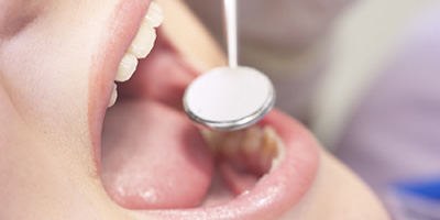 סרטן ראש צוואר