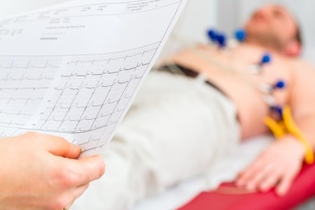 בדיקת אק"ג - אחת מהבדיקות הבסיסיות לאבחון תעוקת חזה. צילום: thinkstock