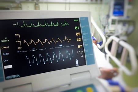  בדיקת אק"ג מבצעת רישום של הפעילות החשמלית בלב. צילום: thinkstock