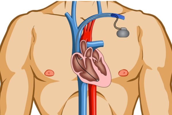 צילום: שאטרסטוק