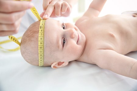 חוסר סימטריה בגלל התגרמות מוקדמת של הגולגולת מתגלה בד"כ במעקב אחר היקף ראשו של התינוק. צילום: שאטרסטוק